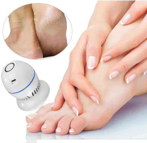 Beauty Feet | Removedor de callos y grietas