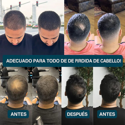 BUNEE®  — Camuflaje capilar profesional